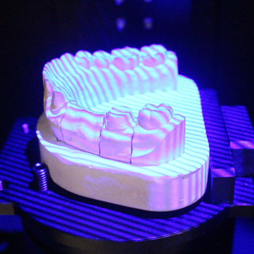 Blue Light 3D Dental Scanner