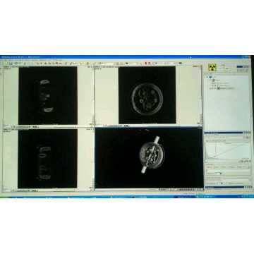 X Ray Flat panel detector Image processing system