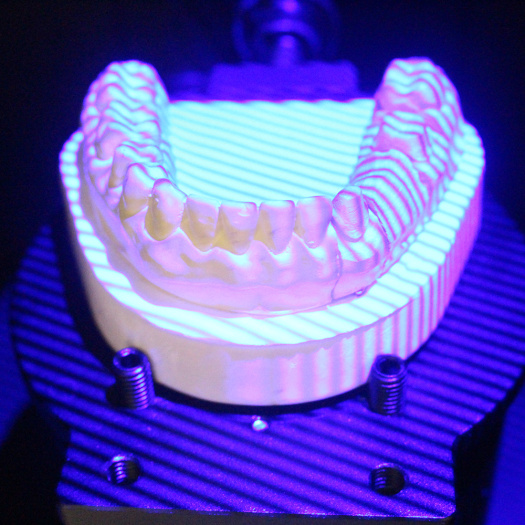 3d dental impression scanner